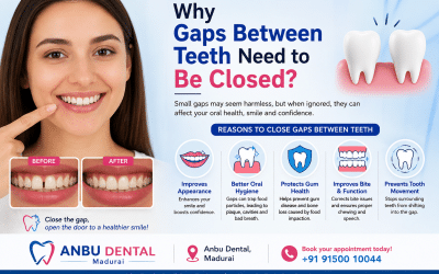 Why Do Gaps Between Teeth Need to Be Closed?