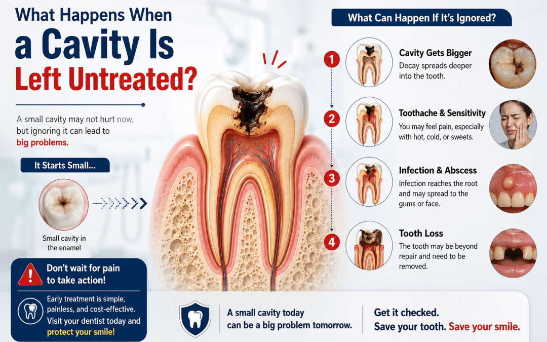 What Happens When a Cavity Is Left Untreated?