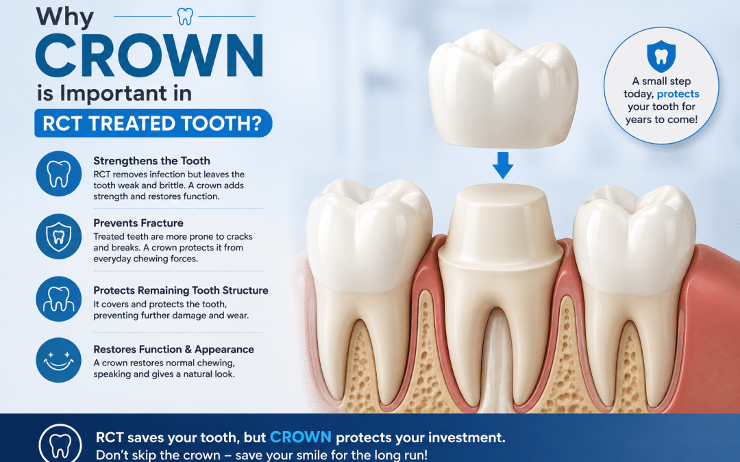 Why Is a Crown Important After Root Canal Treatment?